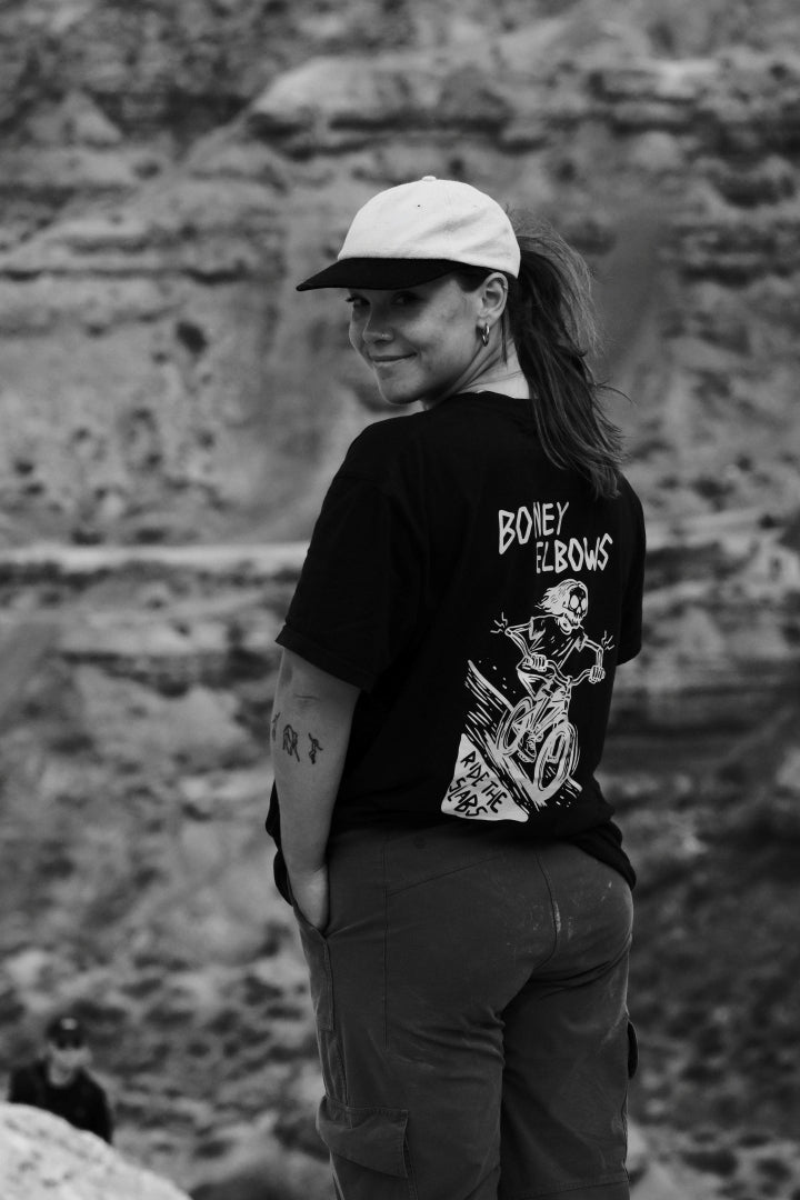 Boney Elbows * Black